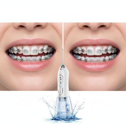 H2ofloss Hydropulseur Dentaire